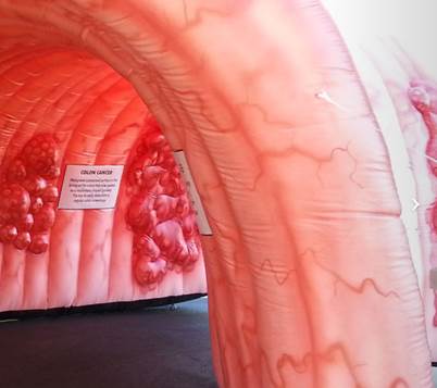 Inflatable Colon