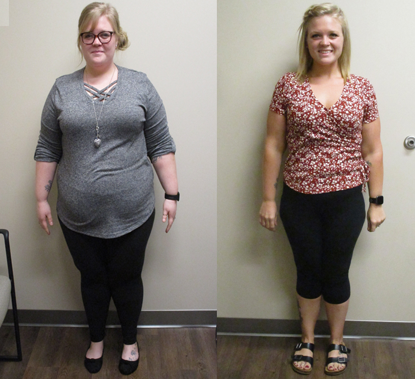 Liberty weight loss before and after photo 
