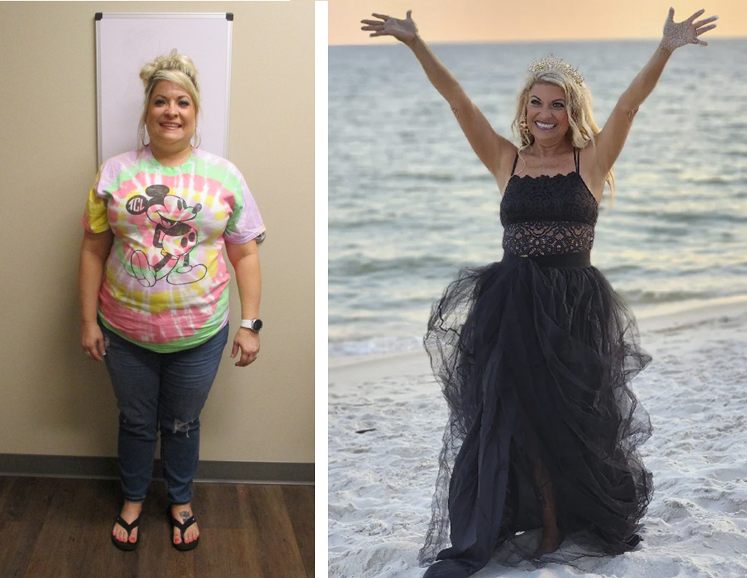Tracy's before and after photos