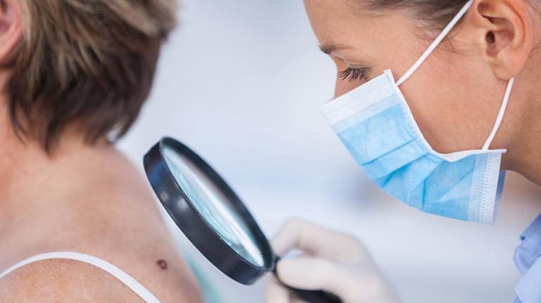 patient getting checked for skin cancer patient getting checked for skin cancer