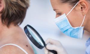 patient getting checked for skin cancer
